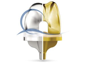 mobile bearing knee replacement implant GMK primary